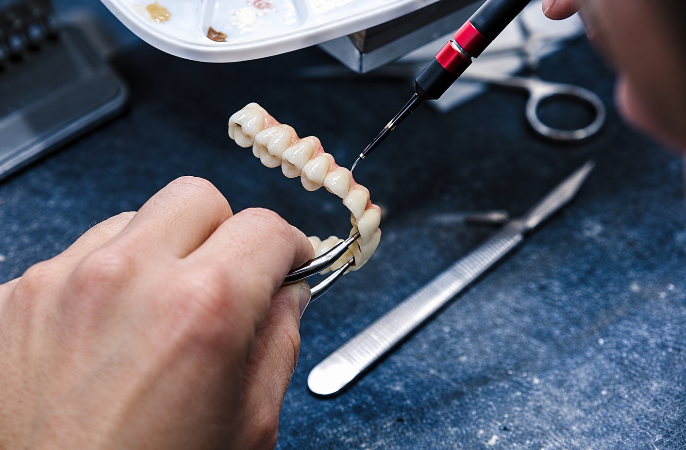 Dental technician creating a custom restoration at a dental restoration lab in California.