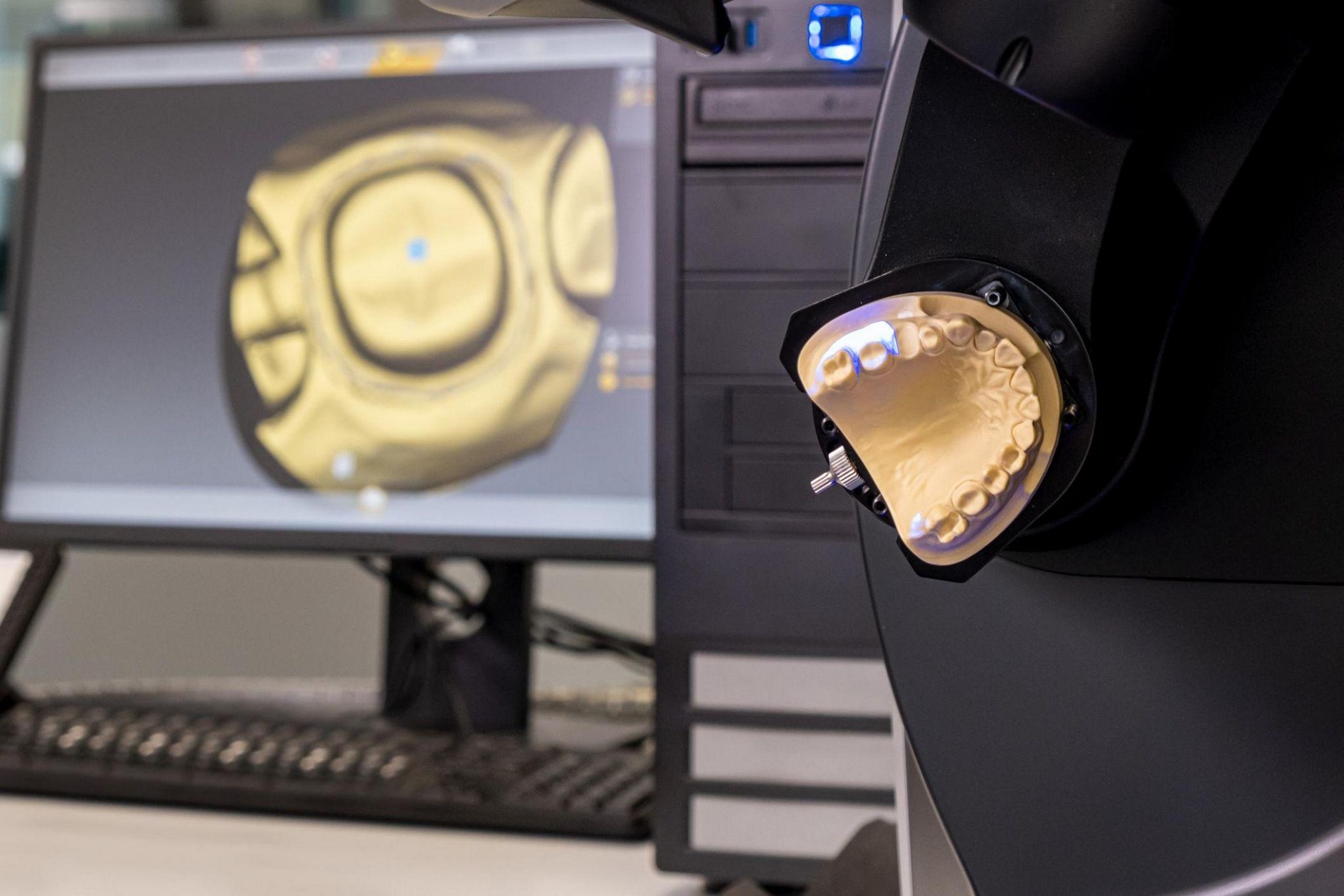 Dental model scanner converting a traditional dental model into a digital CAD file for analog to digital dental in California.