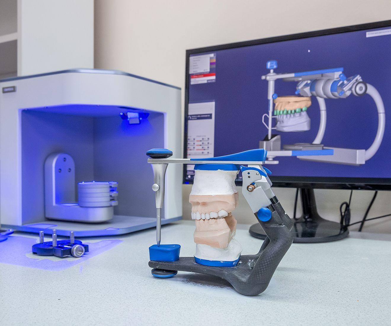 Physical dental cast and digital CAD model illustrating dental CAD conversion in California.