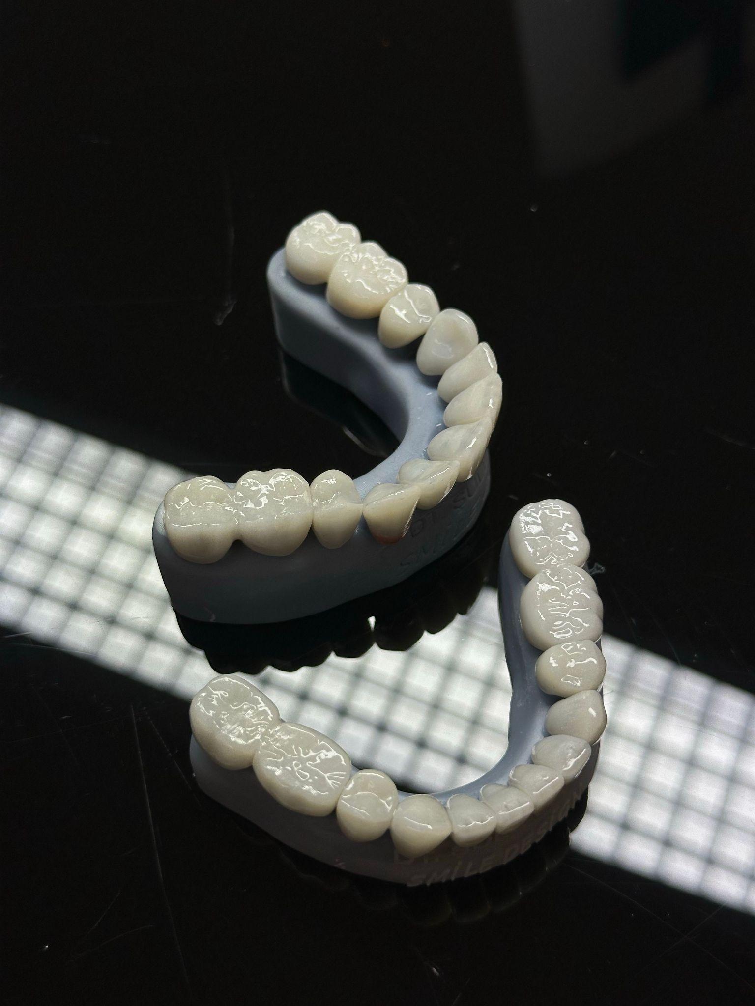 Dental technician finishing a restoration