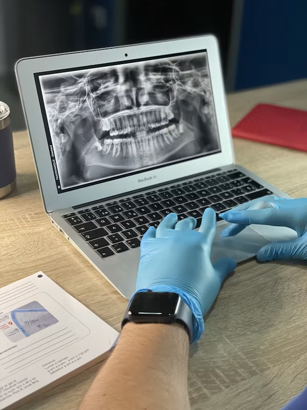 CAD/CAM technology used for digital dental restorations