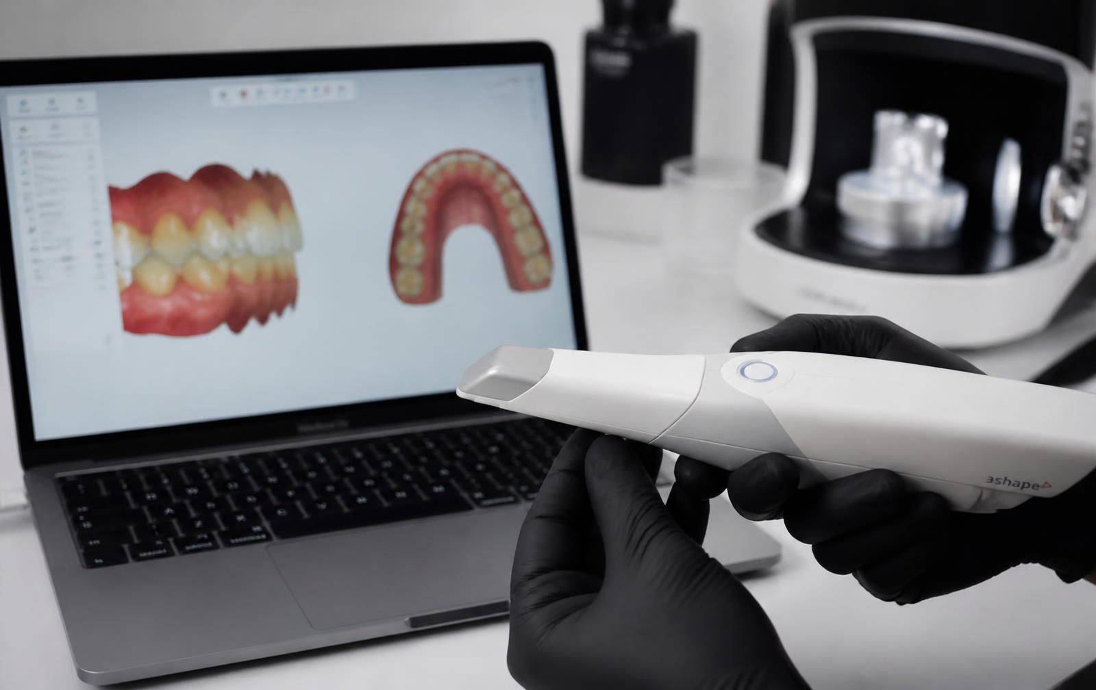 Gloved hands holding an intraoral scanner next to a laptop displaying digital dental scan files in a modern lab