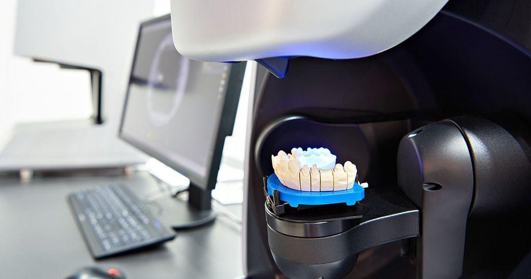 Dental model being scanned during analog to digital dental conversion in Atwater