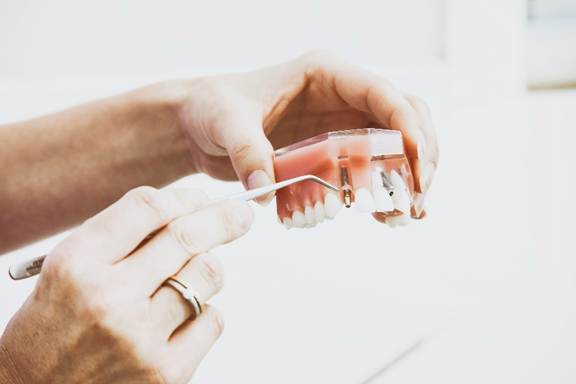 Premium dental prosthesis in California being examined by a dental professional using a tooth model