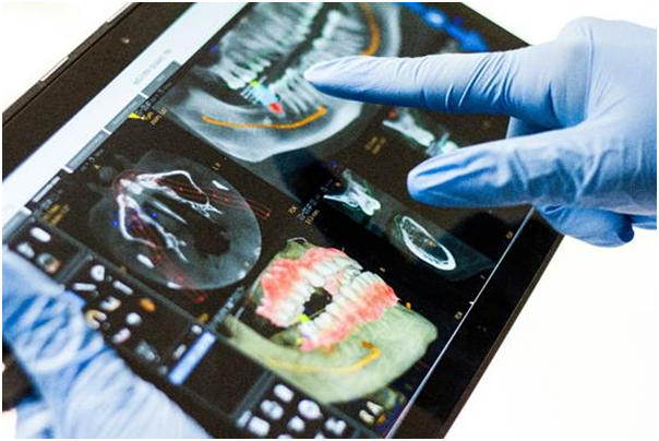 Dentist using digital imaging during dental workflow consulting in California to improve treatment planning