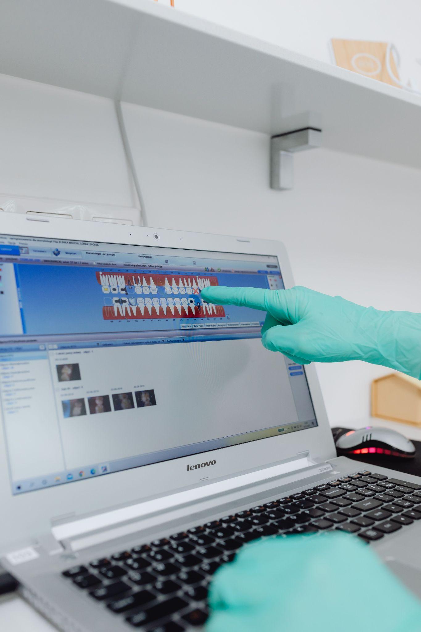 Dental restoration finishing process
